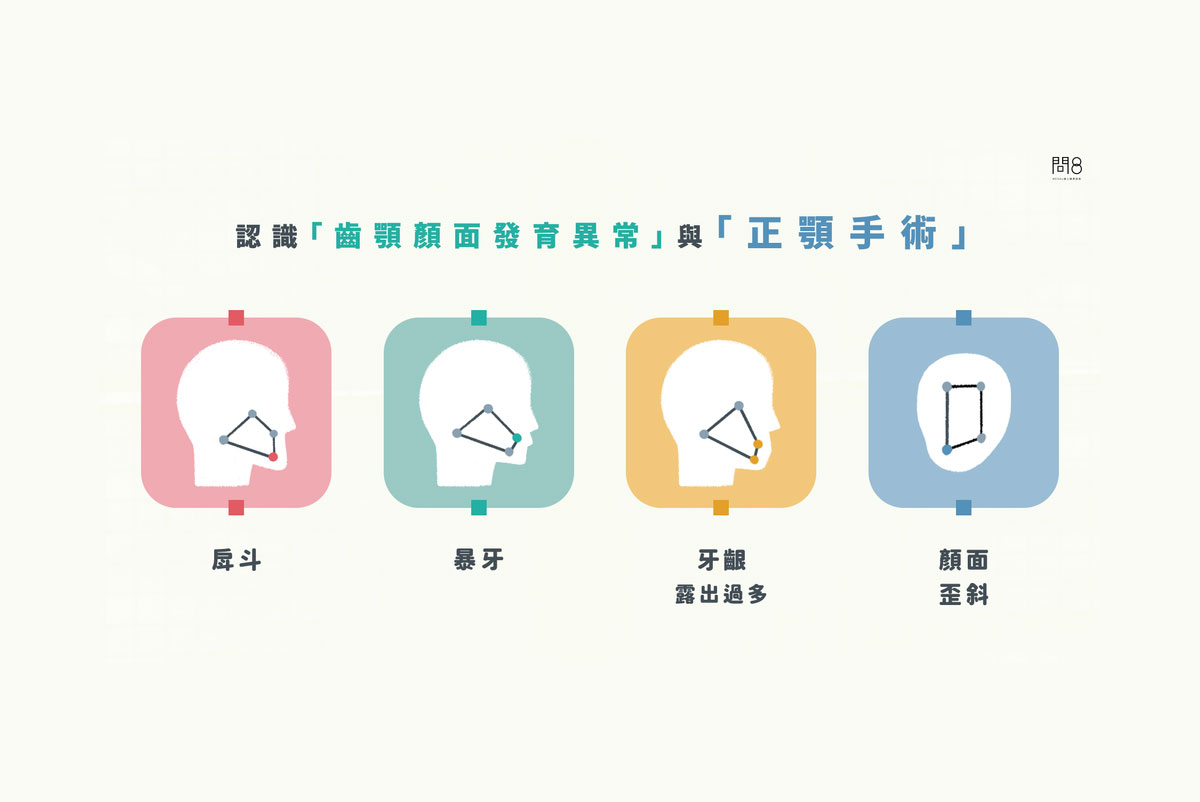 【謝明吉醫師】認識「齒顎顏面發育異常」與「正顎手術」